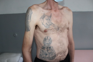 (2)